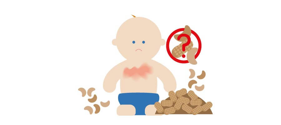 Illustration baby with allergies