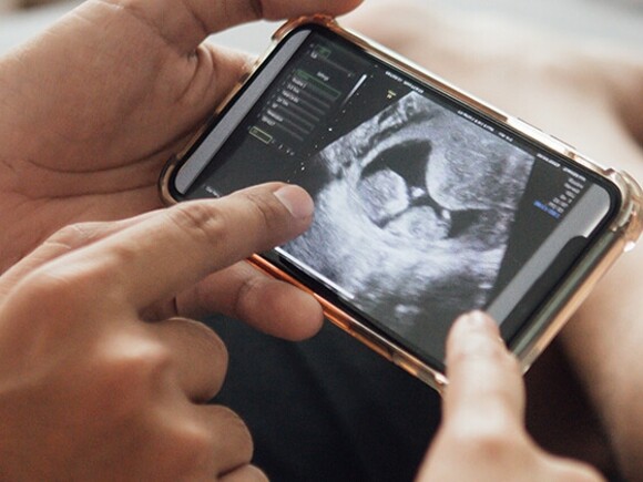 Questions to ask at your 12-week ultrasound