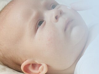 Baby allergies_02_LEARN_Ask the expert_01