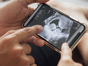 Questions to ask at your 12-week ultrasound Questions to ask at your 12-week ultrasound