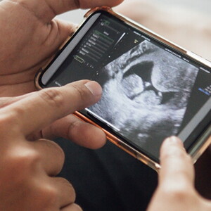 Questions to ask at your 12-week ultrasound Questions to ask at your 12-week ultrasound