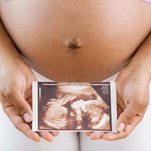 Expectation at 5 month of pregnancy Expectation at 5 month of pregnancy