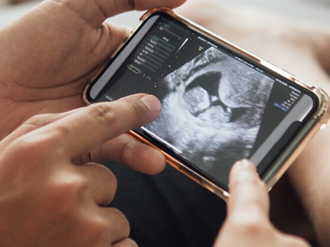 Questions to ask at your 12-week ultrasound Questions to ask at your 12-week ultrasound
