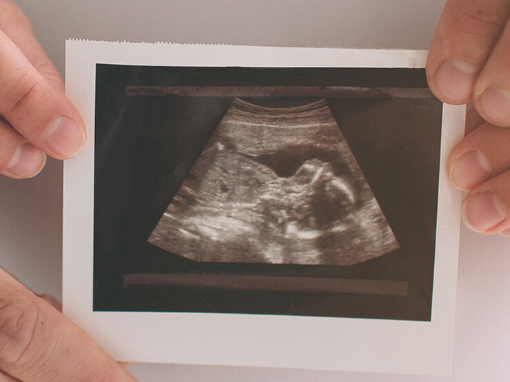 Week by week pregnancy calendar Week by week pregnancy calendar