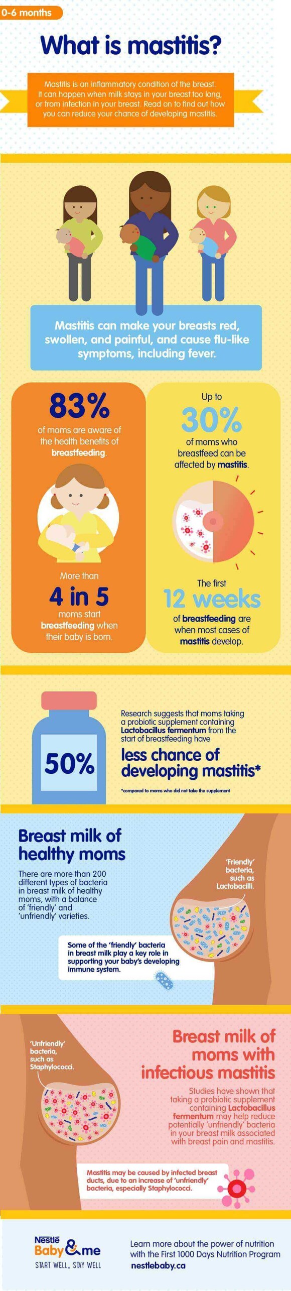 A guide to breastfeeding_16_LEARN_What is mastitis