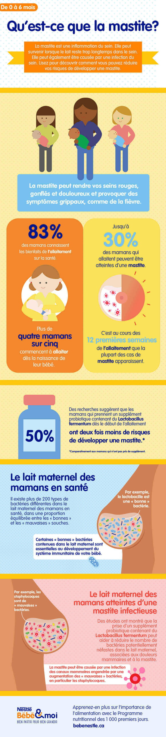 A guide to breastfeeding_16_LEARN_What is mastitis A guide to breastfeeding_16_LEARN_What is mastitis