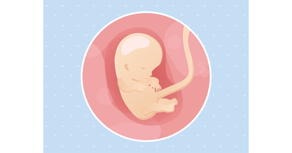 Baby at 10 weeks development cheap